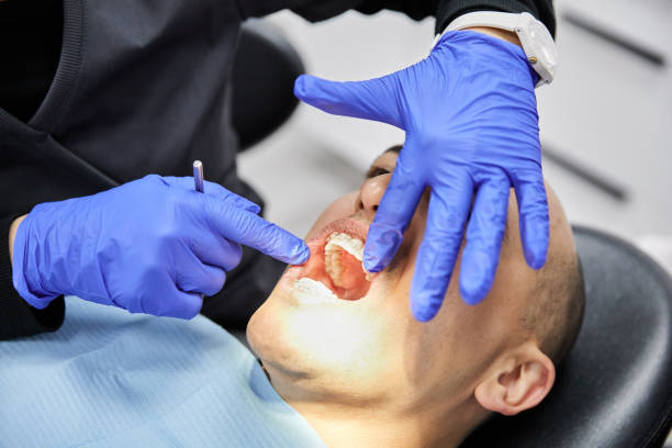 Best Emergency Broken Tooth Repair in Licking, MO